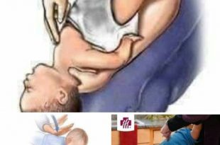 صحة - الاختناق الشردقة